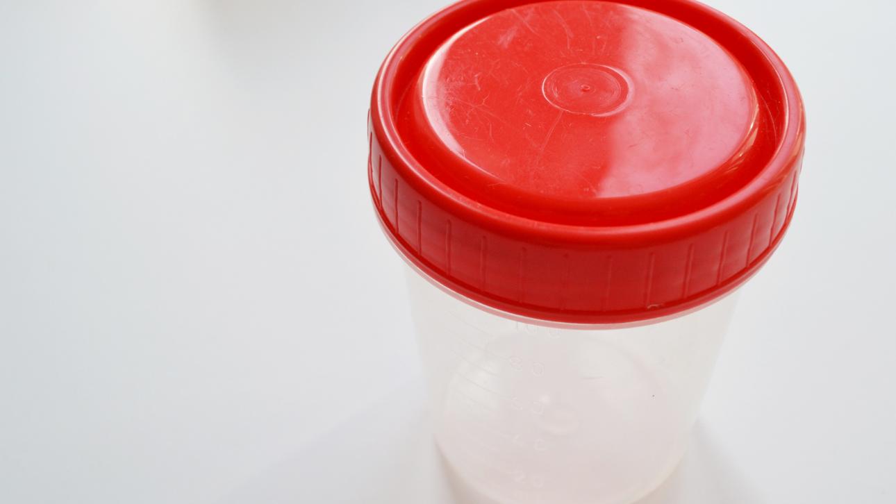 Contenant vide utilisé pour les tests d'urine