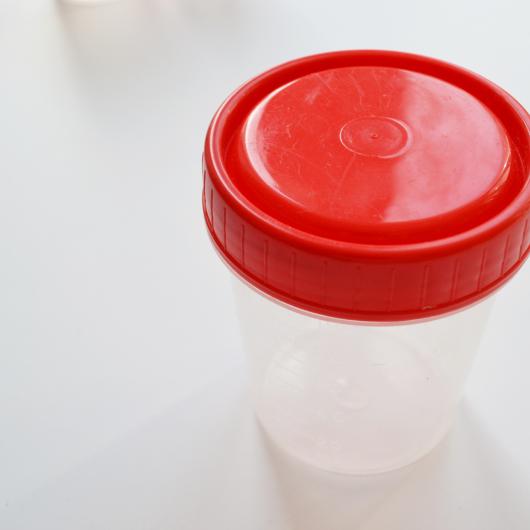 Contenant vide utilisé pour les tests d'urine